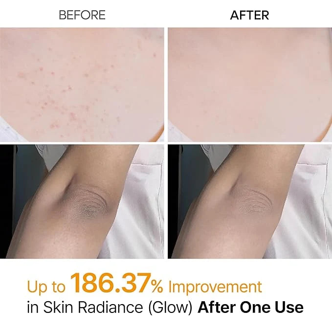 Dr.Melaxin Peel Shot PS Exfoliating Spray (200ml) – Kojic Acid & Turmeric Body & Foot Peeling Mist