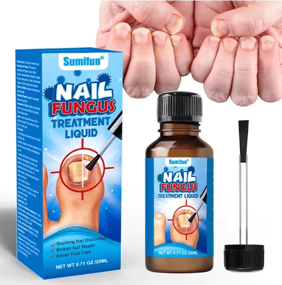Sumifun Nail Fungus Treatment Liquid (20ml) – Antifungal Broken & Discolored Nail Repair Solution