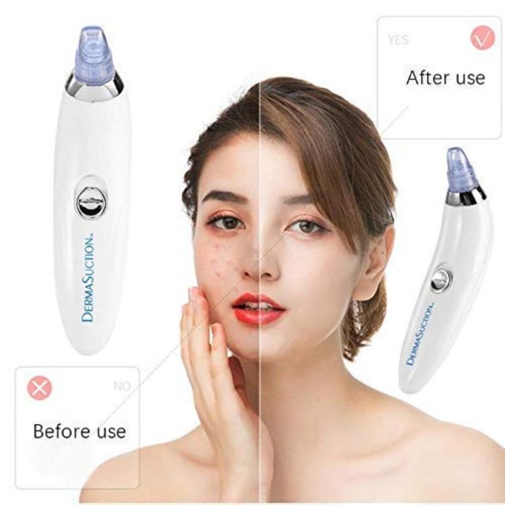 DermaSuction Pore Vacuum & Electric Facial Cleaning Device – Blackhead & Acne Remover